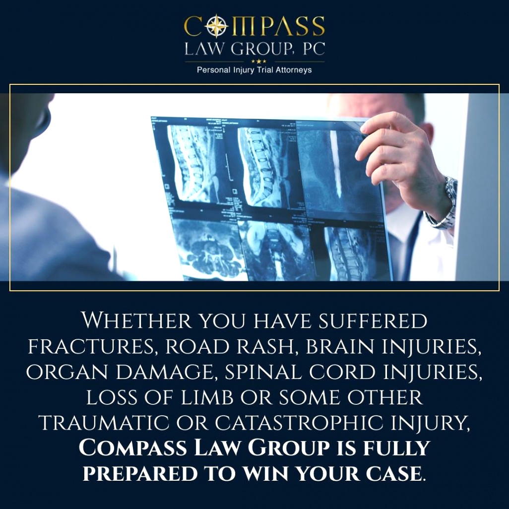pass law group llp injury and accident attorneys 562 247 4001